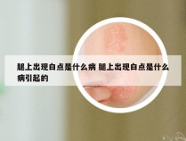 腿上出现白点是什么病 腿上出现白点是什么病引起的