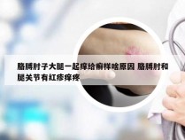 胳膊肘子大腿一起痒给癣样啥原因 胳膊肘和腿关节有红疹痒疼