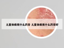 儿童体癣用什么药膏 儿童体癣用什么药膏好