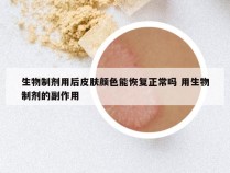 生物制剂用后皮肤颜色能恢复正常吗 用生物制剂的副作用