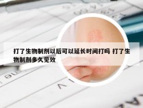 打了生物制剂以后可以延长时间打吗 打了生物制剂多久见效