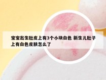 宝宝出生肚皮上有3个小块白色 新生儿肚子上有白色皮肤怎么了