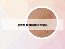 患有外阴银屑病该如何治