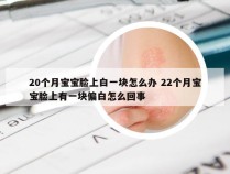 20个月宝宝脸上白一块怎么办 22个月宝宝脸上有一块偏白怎么回事