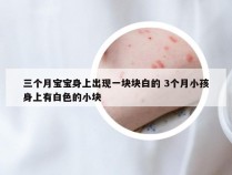 三个月宝宝身上出现一块块白的 3个月小孩身上有白色的小块