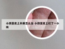 小孩蛋皮上长癣怎么治 小孩蛋皮上红了一小块