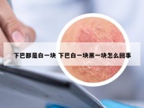 下巴都是白一块 下巴白一块黑一块怎么回事