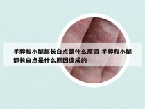 手脖和小腿都长白点是什么原因 手脖和小腿都长白点是什么原因造成的