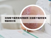 沈阳哪个医院有生物制剂 沈阳哪个医院有生物制剂针剂