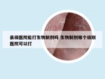 县级医院能打生物制剂吗 生物制剂哪个级别医院可以打