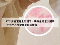 17个月宝宝身上出现了一块白色班怎么回事 十七个月宝宝身上起红疙瘩