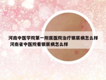 河南中医学院第一附属医院治疗银屑病怎么样 河南省中医院看银屑病怎么样