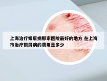 上海治疗银屑病那家医院最好的地方 在上海市治疗银屑病的费用是多少