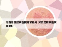 河南省皮肤病医院哪家最好 河南皮肤病医院哪里好