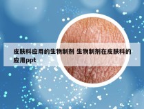 皮肤科应用的生物制剂 生物制剂在皮肤科的应用ppt