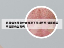 银屑病关节炎什么情况下可以怀孕 银屑病关节炎影响生育吗