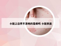 小腿上边界不清晰的是癣吗 小腿表面