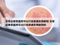 石家庄哪家医院可以打皮肤病生物制剂 石家庄哪家医院可以打皮肤病生物制剂的