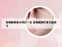 生物制剂多少天打一次 生物制剂打多久能停下