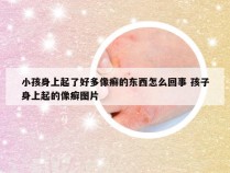 小孩身上起了好多像癣的东西怎么回事 孩子身上起的像癣图片