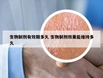 生物制剂有效期多久 生物制剂效果能维持多久