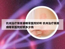 杭州治疗银屑病哪家医院好啊 杭州治疗银屑病哪家医院好啊多少钱