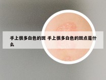 手上很多白色的斑 手上很多白色的斑点是什么