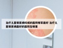 治疗儿童银屑病权威的医院哪家最好 治疗儿童银屑病最好的医院在哪里