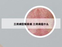 三阴病型银屑病 三阴病是什么