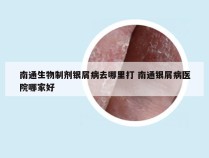 南通生物制剂银屑病去哪里打 南通银屑病医院哪家好