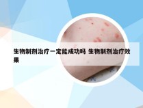 生物制剂治疗一定能成功吗 生物制剂治疗效果