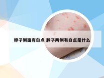 脖子侧面有白点 脖子两侧有白点是什么