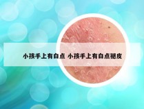 小孩手上有白点 小孩手上有白点褪皮