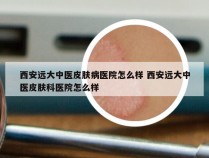 西安远大中医皮肤病医院怎么样 西安远大中医皮肤科医院怎么样