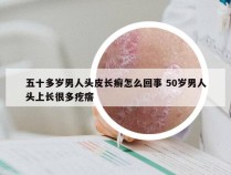 五十多岁男人头皮长癣怎么回事 50岁男人头上长很多疙瘩