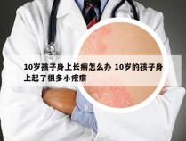 10岁孩子身上长癣怎么办 10岁的孩子身上起了很多小疙瘩