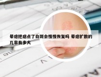 晕痣把痣点了白斑会慢慢恢复吗 晕痣扩散的几率有多大