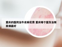 重庆的医院治牛皮癣花费 重庆哪个医生治银屑病最好