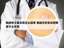 胸部有少量白斑怎么回事 胸部长的有白斑那是什么东西