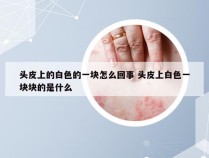 头皮上的白色的一块怎么回事 头皮上白色一块块的是什么