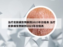 治疗皮肤病生物制剂2023年价格表 治疗皮肤病生物制剂2023年价格表