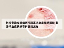 长沙专治皮肤病医院联系鸿业皮肤病医院 长沙鸿业皮肤病专科医院怎样