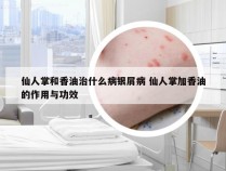 仙人掌和香油治什么病银屑病 仙人掌加香油的作用与功效