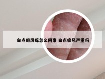 白点癫风痒怎么回事 白点癫风严重吗