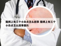 胳膊上有三个小白点怎么回事 胳膊上有三个小白点怎么回事图片