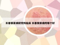 长春银屑病研究所临床 长春银屑病院哪个好