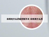 白班吃什么药能控制不长 白班用什么药