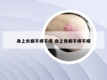 身上长癣不疼不痒 身上有癣不疼不痒