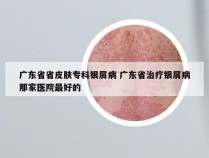 广东省省皮肤专科银屑病 广东省治疗银屑病那家医院最好的