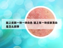 腿上皮肤一块一块白色 腿上有一块皮肤发白是怎么回事